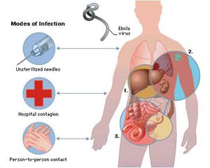 Hướng dẫn chẩn đoán và điều trị bệnh do virus Ebola (tiếp theo)