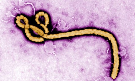 Hướng dẫn chẩn đoán và điều trị bệnh do virus Ebola